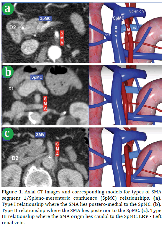 pancreas-axial-ct-images-spmc