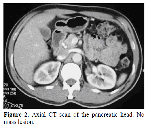 pancreas-axial-ct-scan-pancreatic-head