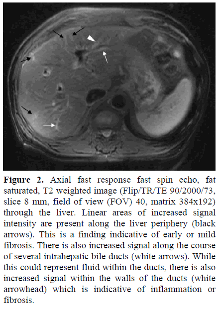 pancreas-axial-fast-response-fast-spin