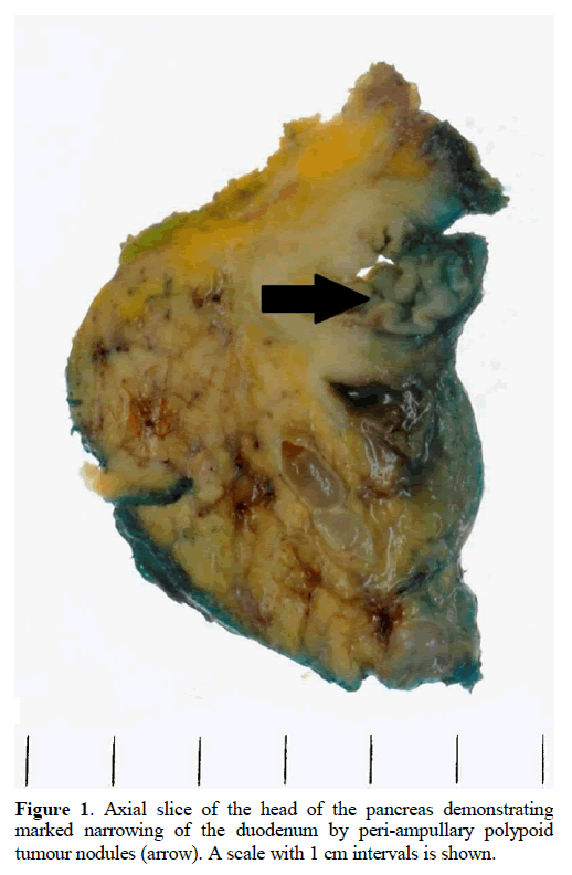 pancreas-axial-head-pancreas