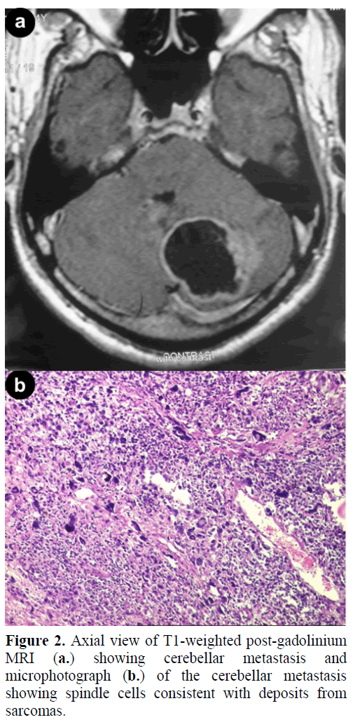 pancreas-axial-view-t1-weighted