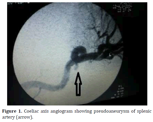 pancreas-axis-angiogram