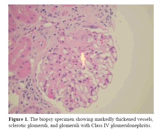 pancreas-biopsy-specimen