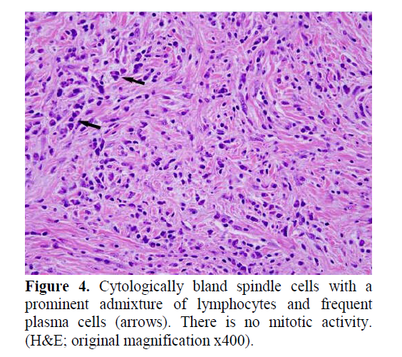 pancreas-bland-spindle-cells