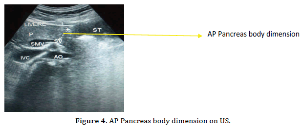 pancreas-body-dimension