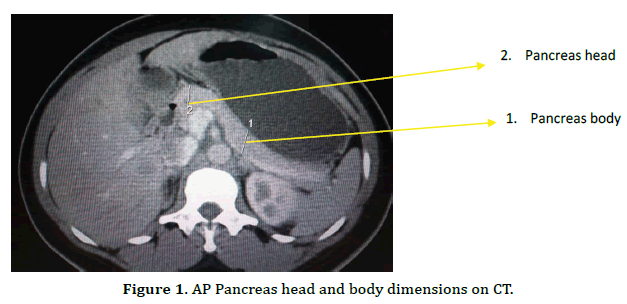 pancreas-body-dimensions