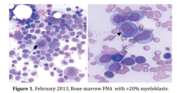 pancreas-bone-marrow-FNA