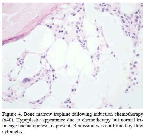 pancreas-bone-marrow-trephine-chemotherapy