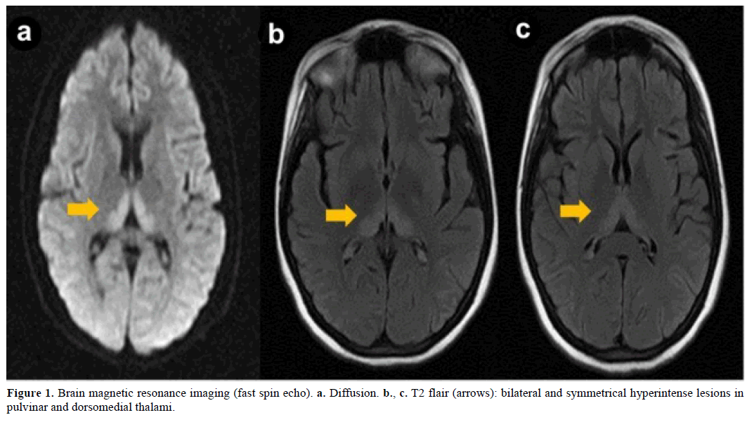 pancreas-brain-magnetic-resonance