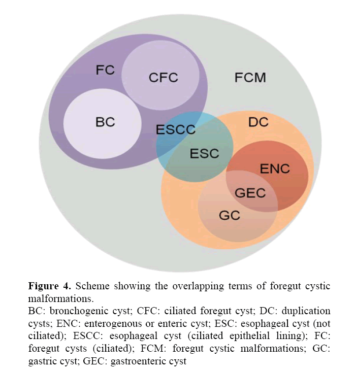 pancreas-bronchogenic-cyst