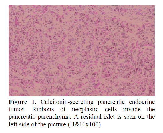 pancreas-calcitonin-secreting-pancreatic