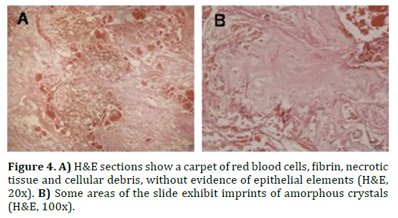 pancreas-carpet-red-blood-cells
