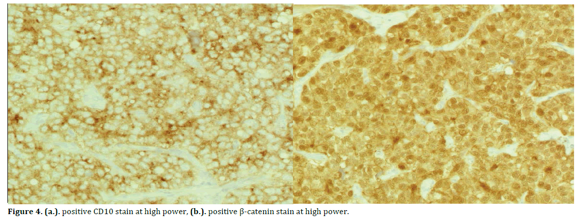 pancreas-catenin-stain-power