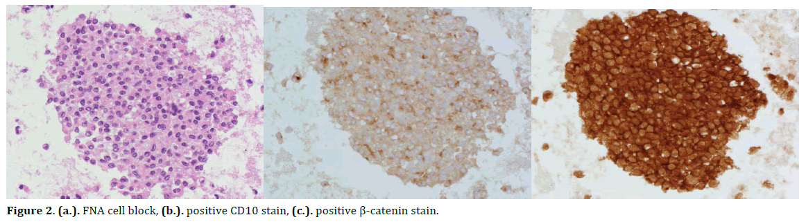 pancreas-catenin-stainy