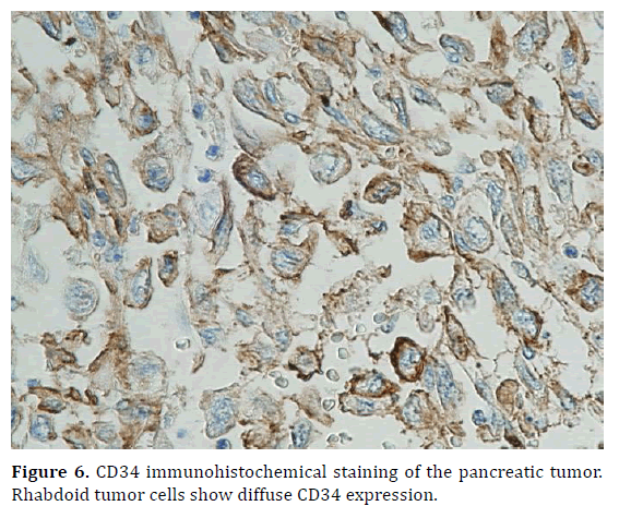 pancreas-cd34-immunohistochemical