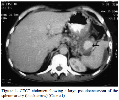 pancreas-cect-abdomen-splenic-artery