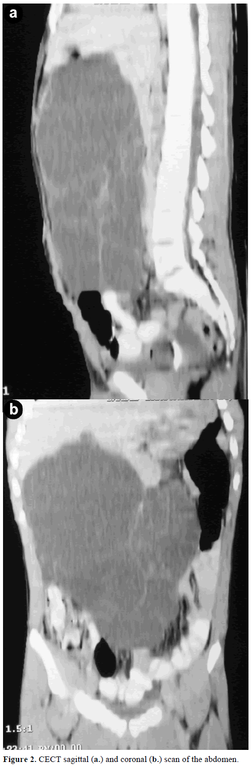 pancreas-cect-sagittal-coronal-abdomen