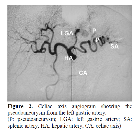pancreas-celiac-axis-angiogram