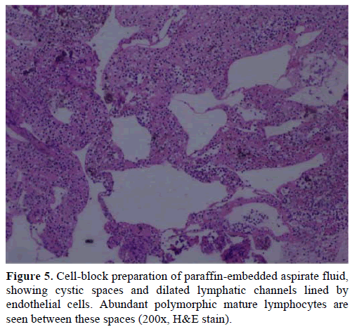 pancreas-cell-block-preparation-fluid