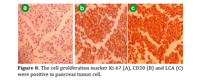 pancreas-cell-proliferation-marker