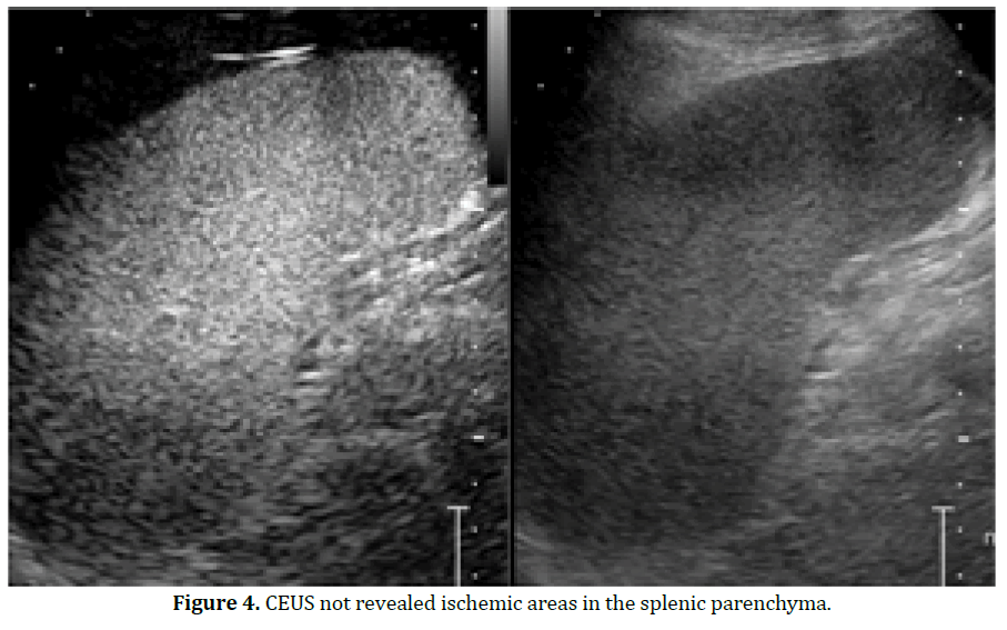 pancreas-ceus-not-revealed-ischemic-areas