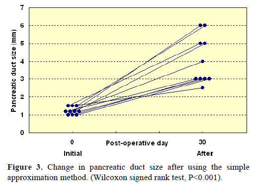 pancreas-change-pancreatic-duct-size