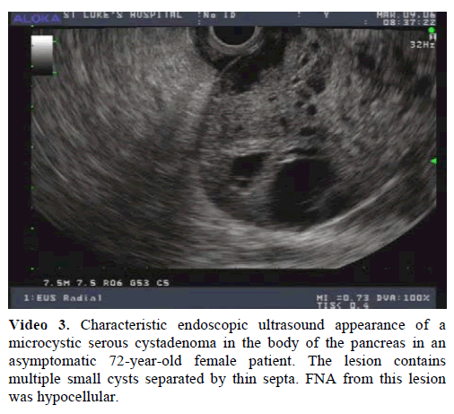 pancreas-characteristic-endoscopic-ultrasound