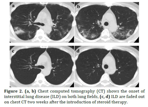 pancreas-chest-computed-tomography