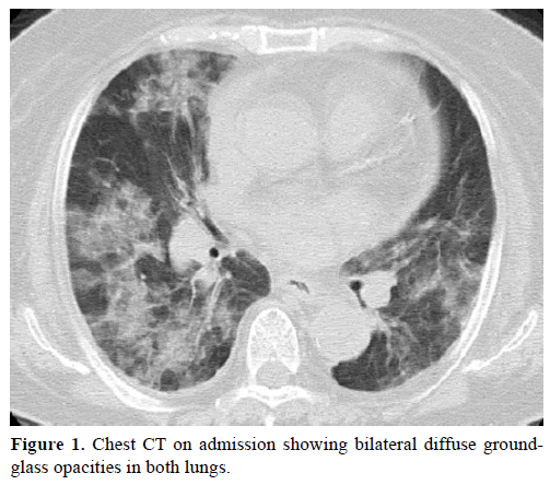 pancreas-chest-ct-bilateral-diffuse