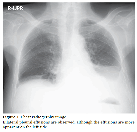 pancreas-chest-radiography-image
