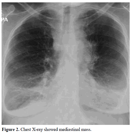 pancreas-chest-x-ray-mediastinal