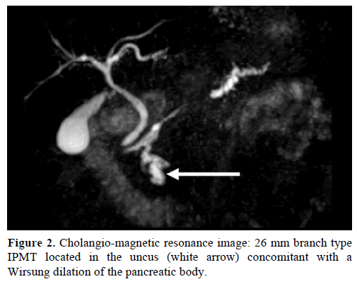 pancreas-cholangio-magnetic-resonance