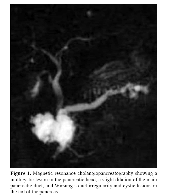 pancreas-cholangiopancreatography