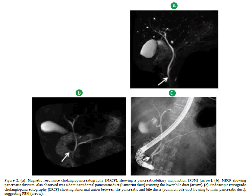 pancreas-cholangiopancreatography