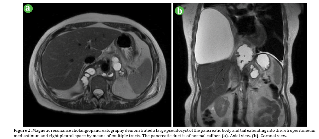 pancreas-cholangiopancreatography