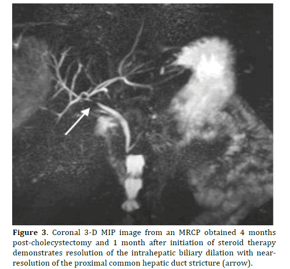 pancreas-cholecystectomy