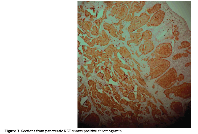 pancreas-chromogranin