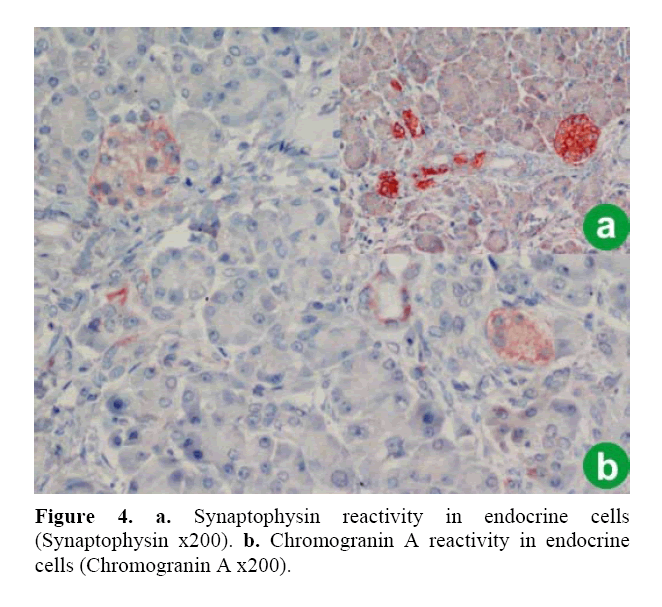 pancreas-chromogranin-reactivity-endocrine