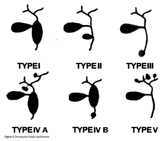 pancreas-classification