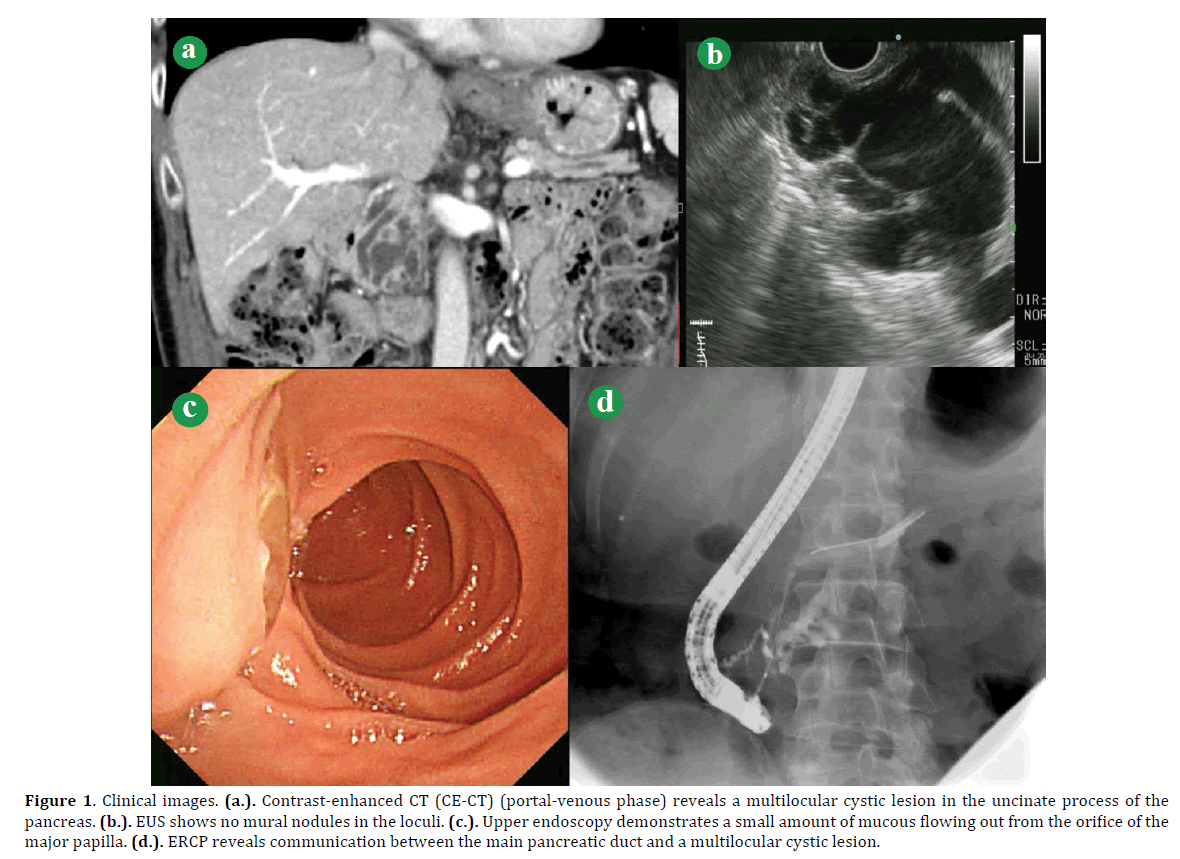 pancreas-clinical-images-contrast-enhanced