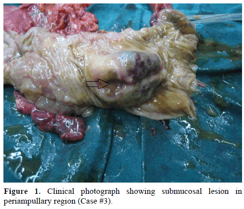 pancreas-clinical-photograph-submucosal