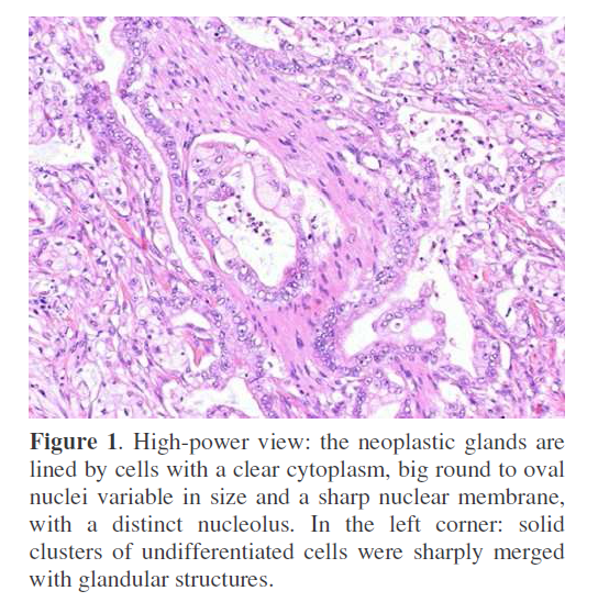 pancreas-clusters-undifferentiated-cells