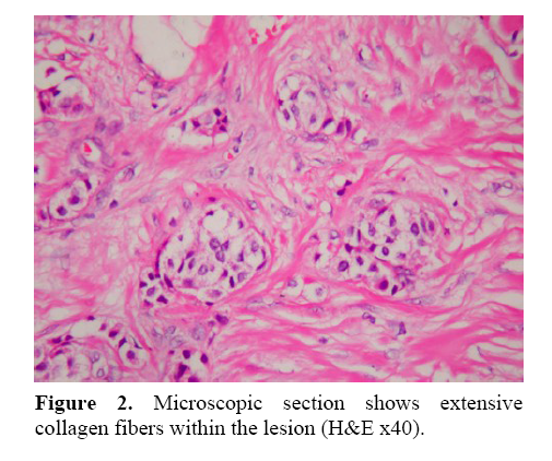 pancreas-collagen-fibers-within