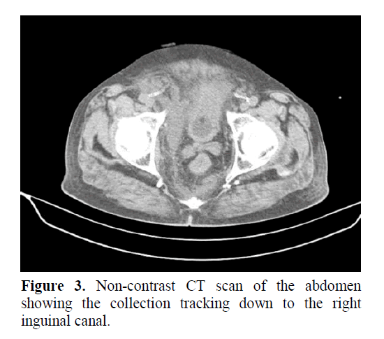 pancreas-collection-tracking-down