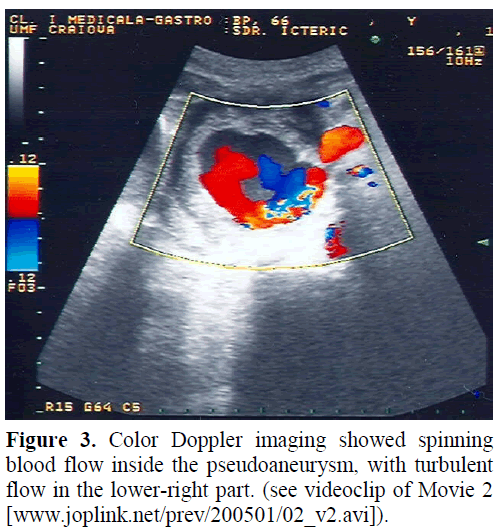 pancreas-color-doppler-imaging-spinning