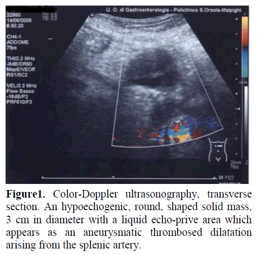 pancreas-color-doppler-ultrasonography