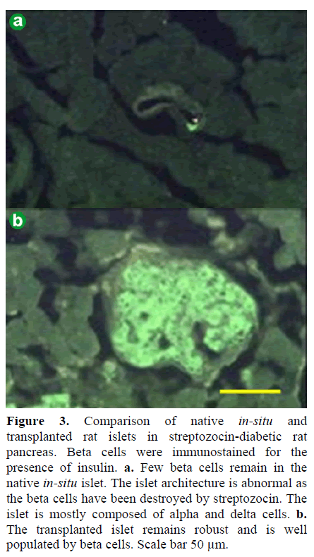 pancreas-comparison-native-streptozocin