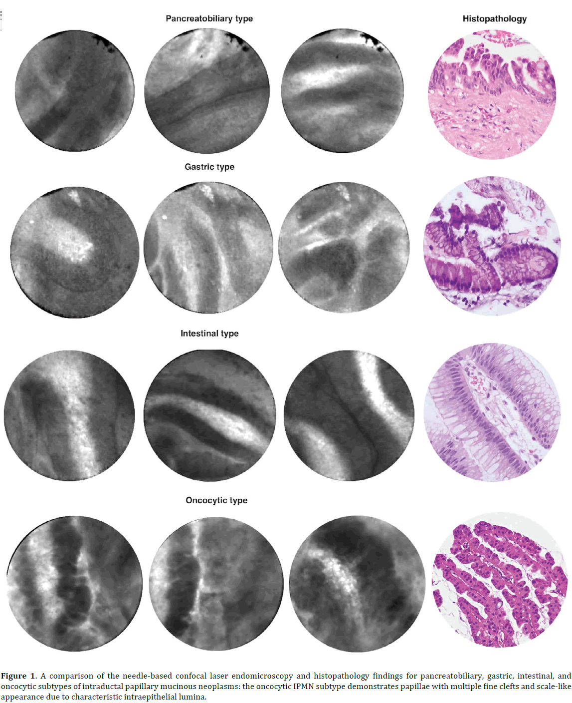 pancreas-comparison-needle-based