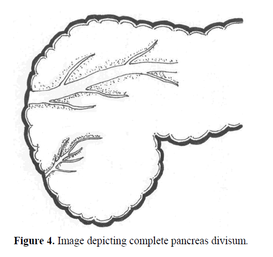 pancreas-complete-pancreas-divisum