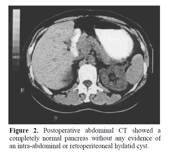 pancreas-completely-normal-pancreas